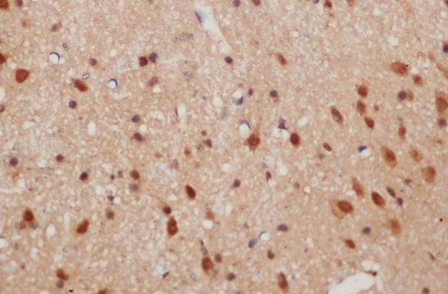 BRAK / CXCL14 Antibody - Immunohistochemistry of paraffin-embedded Mouse brain using CXCL14 Polyclonal Antibody at dilution of 1:50.