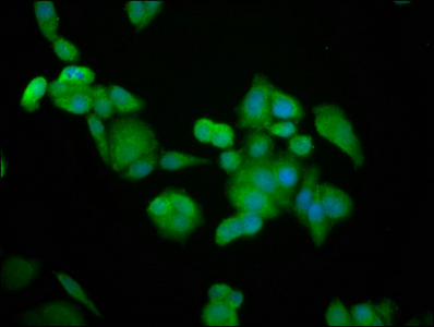 BRAP2 Antibody - Immunofluorescence staining of PC3 cells at a dilution of 1:100, counter-stained with DAPI. The cells were fixed in 4% formaldehyde, permeabilized using 0.2% Triton X-100 and blocked in 10% normal Goat Serum. The cells were then incubated with the antibody overnight at 4°C.The secondary antibody was Alexa Fluor 488-congugated AffiniPure Goat Anti-Rabbit IgG (H+L) .