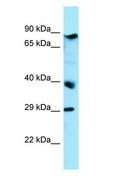BRAT1 / BAAT1 Antibody - BRAT1 / BAAT1 antibody Western Blot of HepG2.  This image was taken for the unconjugated form of this product. Other forms have not been tested.