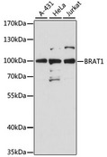 BRAT1 / BAAT1 Antibody - Western blot analysis of extracts of various cell lines, using Brat1 antibody at 1:3000 dilution. The secondary antibody used was an HRP Goat Anti-Rabbit IgG (H+L) at 1:10000 dilution. Lysates were loaded 25ug per lane and 3% nonfat dry milk in TBST was used for blocking. An ECL Kit was used for detection and the exposure time was 30s.