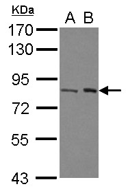 BRAT1 / BAAT1 Antibody - Sample (30 ug of whole cell lysate) A: A431 B: Jurkat 7.5% SDS PAGE BRAT1 / BAAT1 antibody diluted at 1:1000