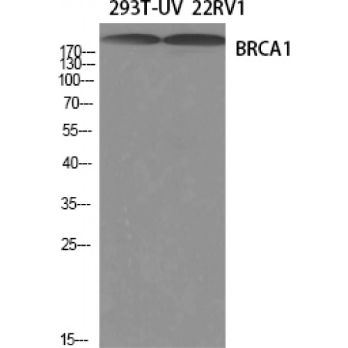 BRCA1 Antibody - Western blot of BRCA1 antibody