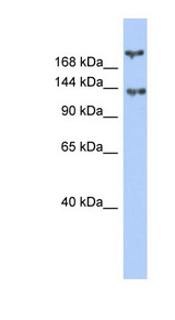 BRCA1 Antibody - BRCA1 antibody Western blot of Fetal Small Intestine lysate. This image was taken for the unconjugated form of this product. Other forms have not been tested.