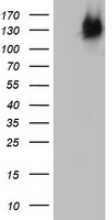BRCA1 Antibody - HEK293T cells were transfected with the pCMV6-ENTRY control (Left lane) or pCMV6-ENTRY BRCA1 (Right lane) cDNA for 48 hrs and lysed. Equivalent amounts of cell lysates (5 ug per lane) were separated by SDS-PAGE and immunoblotted with anti-BRCA1.