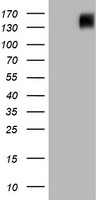 BRCA1 Antibody - HEK293T cells were transfected with the pCMV6-ENTRY control (Left lane) or pCMV6-ENTRY BRCA1 (Right lane) cDNA for 48 hrs and lysed. Equivalent amounts of cell lysates (5 ug per lane) were separated by SDS-PAGE and immunoblotted with anti-BRCA1.