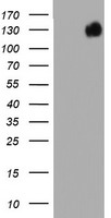 BRCA1 Antibody - HEK293T cells were transfected with the pCMV6-ENTRY control (Left lane) or pCMV6-ENTRY BRCA1 (Right lane) cDNA for 48 hrs and lysed. Equivalent amounts of cell lysates (5 ug per lane) were separated by SDS-PAGE and immunoblotted with anti-BRCA1.