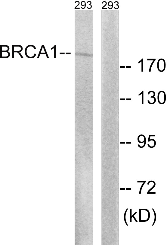 BRCA1 Antibody - Western blot analysis of lysates from 293 cells treated with epo 20U/ml 15', using BRCA1 Antibody. The lane on the right is blocked with the synthesized peptide.