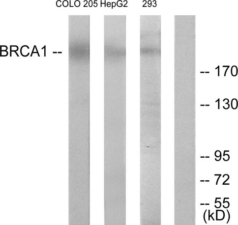 BRCA1 Antibody - Western blot analysis of lysates from COLO205 and HepG2 cells, treated with serum 20% 15', using BRCA1 Antibody. The lane on the right is blocked with the synthesized peptide.