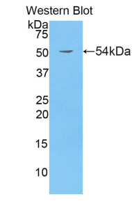 BRCA1 Antibody - Western blot of recombinant BRCA1.  This image was taken for the unconjugated form of this product. Other forms have not been tested.