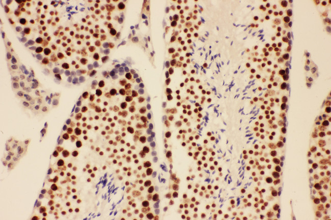 BRCA1 Antibody - BRCA1 antibody. IHC(P): Mouse Testis Tissue.