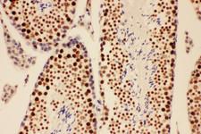 BRCA1 Antibody - BRCA1 antibody. IHC(P): Mouse Testis Tissue.