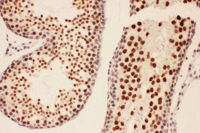 BRCA1 Antibody - BRCA1 antibody. IHC(P): Rat Testis Tissue.