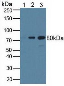BRCA1 Antibody - Western Blot; .Sample: Lane1: Human A431 Cells; Lane2: Human Hela Cells; Lane3: Mouse Testis Tissue.