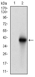 BRCA1 Antibody - Western blot using BRCA1 monoclonal antibody against HEK293 (1) and BRCA1 (AA: 229-335)-hIgGFc transfected HEK293 (2) cell lysate.