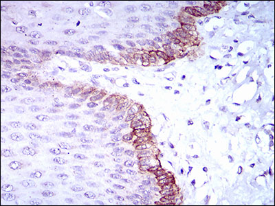 BRCA1 Antibody - IHC of paraffin-embedded esophagus tissues using BRCA1 mouse monoclonal antibody with DAB staining.