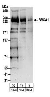 BRCA1 Antibody - Detection of Human BRCA1 by Western Blot. Samples: Whole cell lysate (5, 15 and 50 ug) from HeLa cells. Antibodies: Affinity purified rabbit anti-BRCA1 antibody used for WB at 1 ug/ml. Detection: Chemiluminescence with an exposure time of 3 minutes.