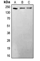 BRCA1 Antibody - Western blot analysis of BRCA1 expression in HeLa (A); mouse kidney (B); rat brain (C) whole cell lysates.