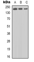 BRCA1 Antibody - Western blot analysis of BRCA1 expression in K562 (A); HEK293T (B); HT29 (C) whole cell lysates.