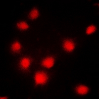 BRCA1 Antibody - Immunofluorescent analysis of BRCA1 staining in MCF7 cells. Formalin-fixed cells were permeabilized with 0.1% Triton X-100 in TBS for 5-10 minutes and blocked with 3% BSA-PBS for 30 minutes at room temperature. Cells were probed with the primary antibody in 3% BSA-PBS and incubated overnight at 4 deg C in a humidified chamber. Cells were washed with PBST and incubated with a DyLight 594-conjugated secondary antibody (red) in PBS at room temperature in the dark. DAPI was used to stain the cell nuclei (blue).