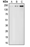 BRCA1 Antibody - Western blot analysis of BRCA1 expression in HeLa (A); mouse liver (B); rat liver (C) whole cell lysates.