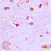 BRCA1 Antibody - Immunohistochemical analysis of BRCA1 staining in human brain formalin fixed paraffin embedded tissue section. The section was pre-treated using heat mediated antigen retrieval with sodium citrate buffer (pH 6.0). The section was then incubated with the antibody at room temperature and detected using an HRP conjugated compact polymer system. DAB was used as the chromogen. The section was then counterstained with hematoxylin and mounted with DPX.