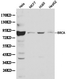 BRCA1 Antibody - Western blot of BRCA1 pAb in extracts from Hela, MCF7, HL60 and HepG2 cells.