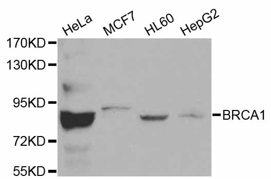 BRCA1 Antibody - Western blot analysis of extracts of various cell lines, using BRCA1 antibody. The secondary antibody used was an HRP Goat Anti-Rabbit IgG (H+L) at 1:10000 dilution. Lysates were loaded 25ug per lane and 3% nonfat dry milk in TBST was used for blocking.