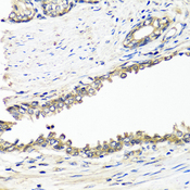 BRCA1 Antibody - Immunohistochemistry of paraffin-embedded human prostate using BRCA1 antibodyat dilution of 1:100 (40x lens).