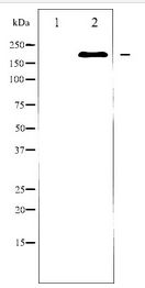 BRCA1 Antibody - Western blot of BRCA1 expression in serum treated COLO205 whole cell lysates,The lane on the left is treated with the antigen-specific peptide.
