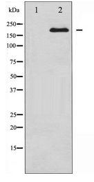 BRCA1 Antibody - Western blot of BRCA1 expression in whole cell lysates,The lane on the left is treated with the antigen-specific peptide.