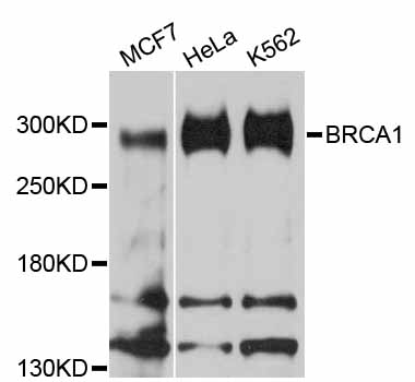 BRCA1 Antibody - Western blot analysis of extracts of various cell lines, using BRCA1 antibody at 1:1000 dilution. The secondary antibody used was an HRP Goat Anti-Rabbit IgG (H+L) at 1:10000 dilution. Lysates were loaded 25ug per lane and 3% nonfat dry milk in TBST was used for blocking. An ECL Kit was used for detection and the exposure time was 90s.