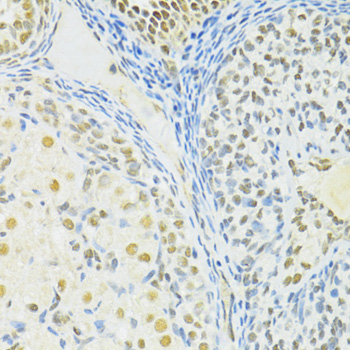 BRCA1 Antibody - Immunohistochemistry of paraffin-embedded rat ovary using BRCA1 antibody at dilution of 1:100 (40x lens).