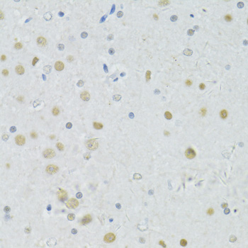 BRCA1 Antibody - Immunohistochemistry of paraffin-embedded rat brain using BRCA1 antibody at dilution of 1:100 (40x lens).