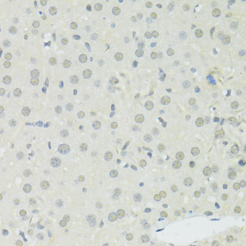 BRCA1 Antibody - Immunohistochemistry of paraffin-embedded mouse liver using BRCA1 antibody at dilution of 1:100 (40x lens).