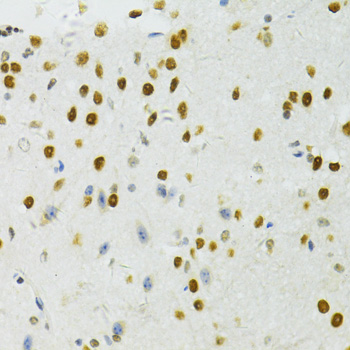 BRCA1 Antibody - Immunohistochemistry of paraffin-embedded mouse spinal cord using BRCA1 antibody at dilution of 1:100 (40x lens).
