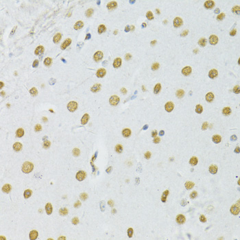 BRCA1 Antibody - Immunohistochemistry of paraffin-embedded mouse brain using BRCA1 antibody at dilution of 1:100 (40x lens).