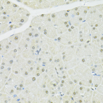 BRCA1 Antibody - Immunohistochemistry of paraffin-embedded mouse pancreas using BRCA1 antibody at dilution of 1:100 (40x lens).
