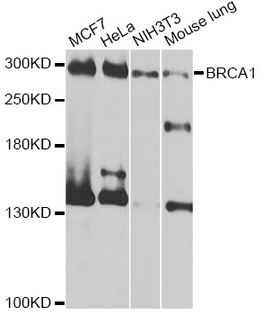 BRCA1 Antibody - Western blot analysis of extracts of various cell lines, using BRCA1 antibody at 1:1000 dilution. The secondary antibody used was an HRP Goat Anti-Rabbit IgG (H+L) at 1:10000 dilution. Lysates were loaded 25ug per lane and 3% nonfat dry milk in TBST was used for blocking. An ECL Kit was used for detection and the exposure time was 1s.