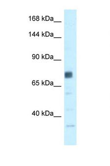 BRCA1 Antibody - BRCA1 antibody Western blot of HepG2 Cell lysate. Antibody concentration 1 ug/ml. This image was taken for the unconjugated form of this product. Other forms have not been tested.