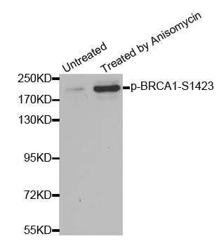 BRCA1 Antibody - Western blot analysis of extracts from HT29 cells.