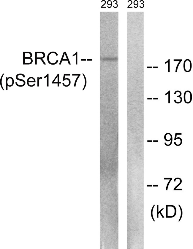 BRCA1 Antibody - Western blot analysis of lysates from 293 cells treated with epo 20U/ml 15', using BRCA1 (Phospho-Ser1457) Antibody. The lane on the right is blocked with the phospho peptide.
