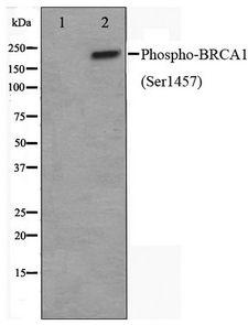 BRCA1 Antibody - Western blot of 293 cell lysate using Phospho-BRCA1(Ser1457) Antibody