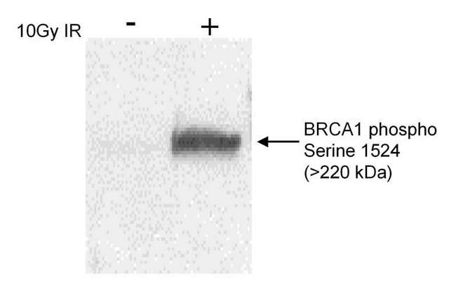 BRCA1 Antibody - Detection of phospho BRCA1 (Ser1524) by Western Blot. Sample: Nuclear extract (50 ug) from HeLa cells mock irradiated or irradiated with 10 Gy of ionizing radiation: Antibody: Affinity purified rabbit anti-BRCA1 phospho Ser1524 used at 0.5 ug/ml. Detection: Chemiluminescence.