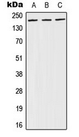 BRCA1 Antibody - Western blot analysis of BRCA1 (pS1524) expression in A431 (A); NIH3T3 (B); PC12 (C) whole cell lysates.