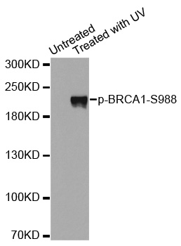 BRCA1 Antibody - Western blot analysis of extracts from Hela cells.