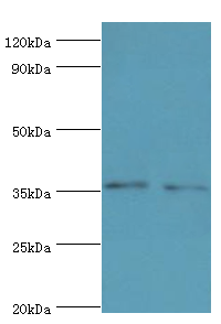 BRCC3 / BRCC36 Antibody - Western blot. All lanes: Lys-63-specific deubiquitinase BRCC36 antibody at 3 ug/ml. Lane 1: 293T whole cell lysate. Lane 2: MCF-7 whole cell lysate. secondary Goat polyclonal to rabbit at 1:10000 dilution. Predicted band size: 36 kDa. Observed band size: 36 kDa.