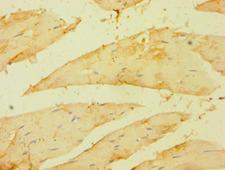 BRCC3 / BRCC36 Antibody - Immunohistochemistry of paraffin-embedded human skeletal muscle using antibody at 1:100 dilution.
