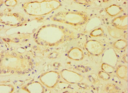 BRCC3 / BRCC36 Antibody - Immunohistochemistry of paraffin-embedded human kidney tissue using BRCC3 Antibody at dilution of 1:100