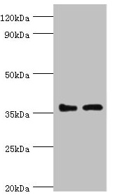 BRCC3 / BRCC36 Antibody - Western blot All lanes: BRCC3 antibody at 3µg/ml Lane 1: 293T whole cell lysate Lane 2: MCF-7 whole cell lysate Secondary Goat polyclonal to rabbit IgG at 1/10000 dilution Predicted band size: 37, 34, 24, 29 kDa Observed band size: 37 kDa