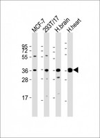 BRCC3 / BRCC36 Antibody - All lanes: Anti-BRCC3 Antibody (N-Term) at 1:2000 dilution. Lane 1: MCF-7 whole cell lysate. Lane 2: 293T/17 whole cell lysate. Lane 3: human brain lysate. Lane 4: human heart lysate Lysates/proteins at 20 ug per lane. Secondary Goat Anti-Rabbit IgG, (H+L), Peroxidase conjugated at 1:10000 dilution. Predicted band size: 36 kDa. Blocking/Dilution buffer: 5% NFDM/TBST.
